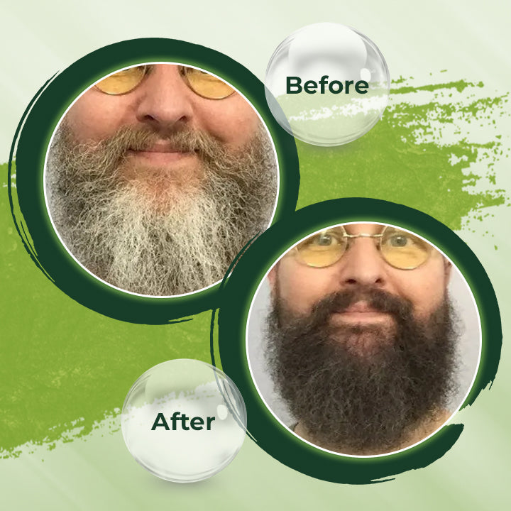 HerbCare™ Shampoo Bar |  1+1 GRATIS!