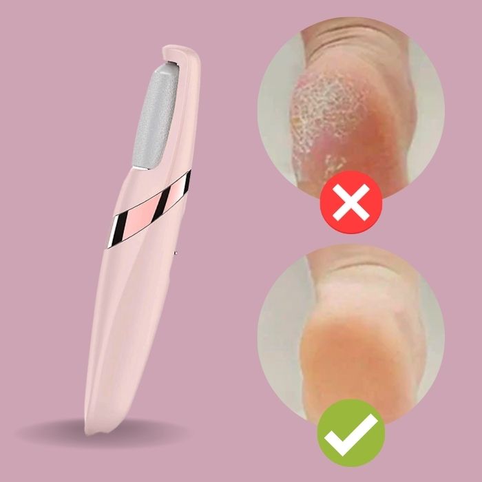 Pedi Elektrische Eckfeile