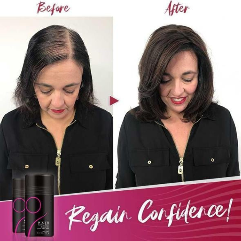 ThickTress™ | Sofortige Dichte für einen volleren Haaransatz