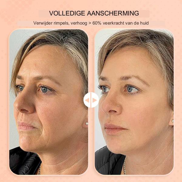 DerolSilky™ - Balsam Zur Faltenentfernung (1+1 GRATIS)