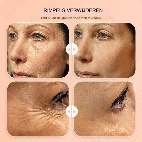 DerolSilky™ - Balsam Zur Faltenentfernung (1+1 GRATIS)