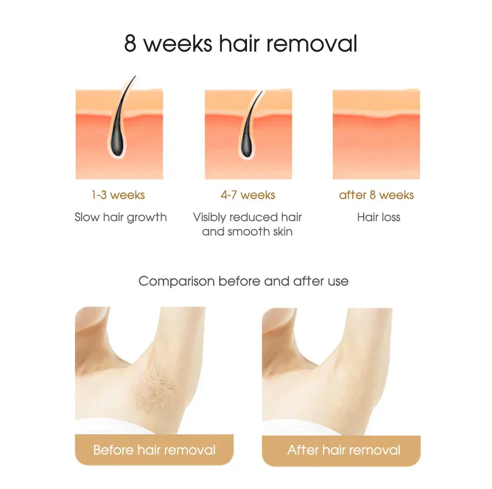 HairRemoval™ - Tragbares Haarentfernungsgerät (50% RABATT)