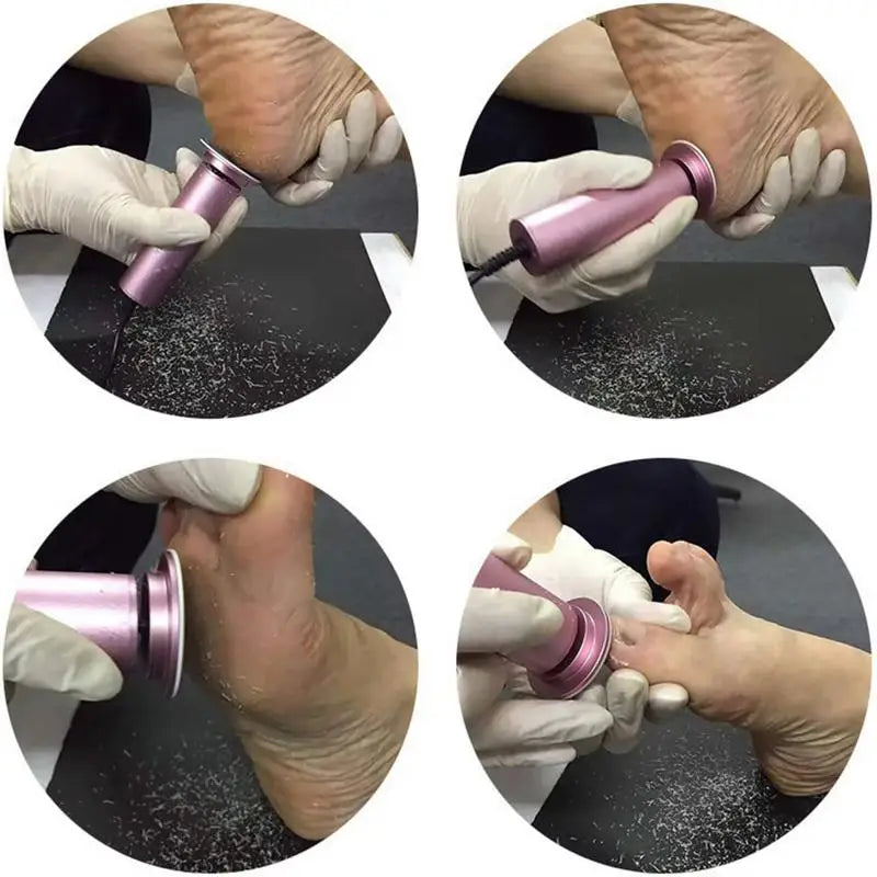 SmoothSole™ | Rissige Haut mühelos entfernen für seidige Füße