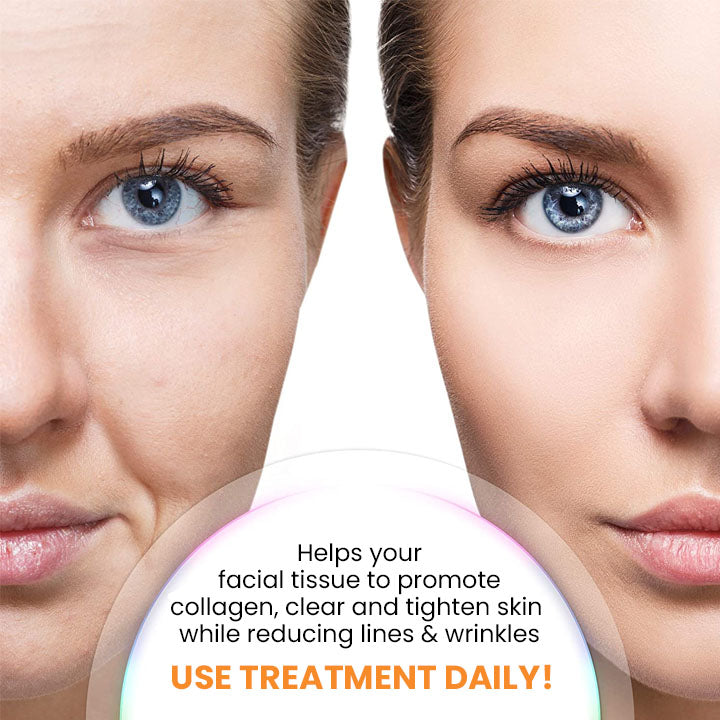 SkinRevive™ - Kollagen-Film-Maske (1+1 GRATIS)