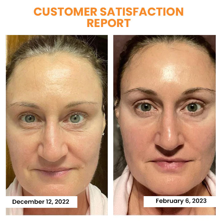 SkinRevive™ - Kollagen-Film-Maske (1+1 GRATIS)