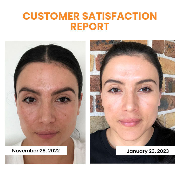 SkinRevive™ - Kollagen-Film-Maske (1+1 GRATIS)