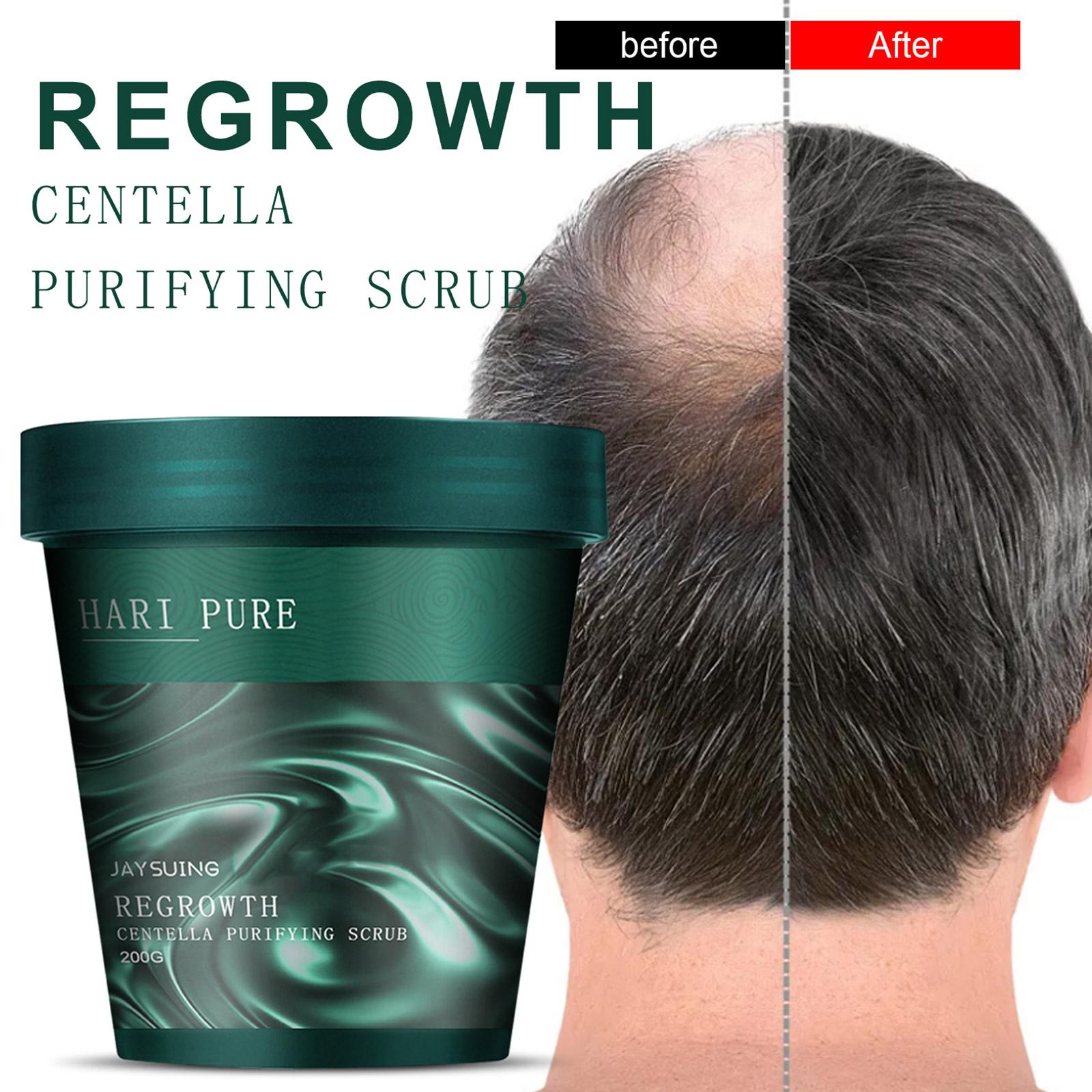 HairPure™ ReGrowth Centella Purifying Scrub 1+1 GRATIS