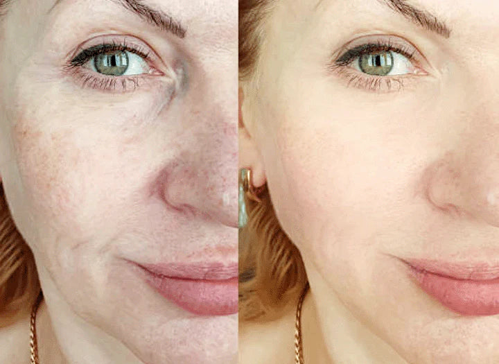 Modioza ™  Turmeric Sérum- Korrektur dunkler Flecken  (1+1 GRATIS)